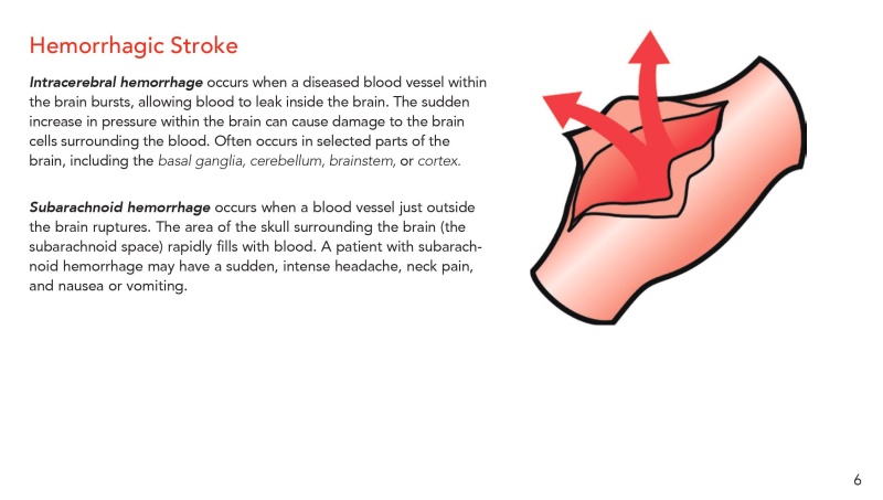 2017 Canadian Stroke Best Practices Stroke Assessment And Prevention ...